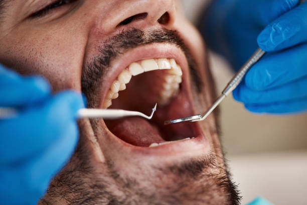 Best Emergency Dentist for Knocked-Out Tooth in Emory, TX